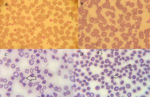 Hình dạng của Mycoplasma suis